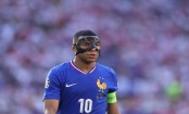 Mbappe plays on with broken nose